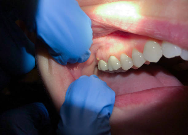 Best Emergency Dentist for Special Needs Patients in Enoch, UT